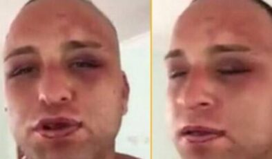 Rum mahkumlar Survivor Taner’i komalık ettiler!